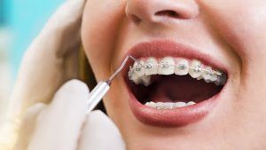 Read more about the article Você sabe o que é ortodontia?