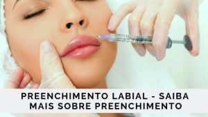 Read more about the article Preenchimento labial – Saiba mais sobre preenchimento